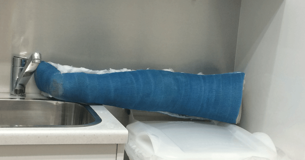 A blue leg cast